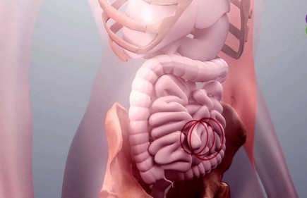 причины отрыжки