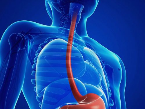 Сужение пищевода – причины развития, особенности терапии, роль диеты