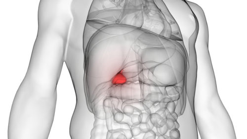 Рак желчного пузыря