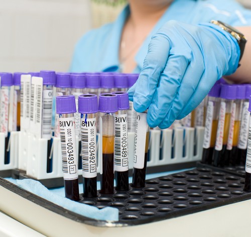 Общий анализ крови