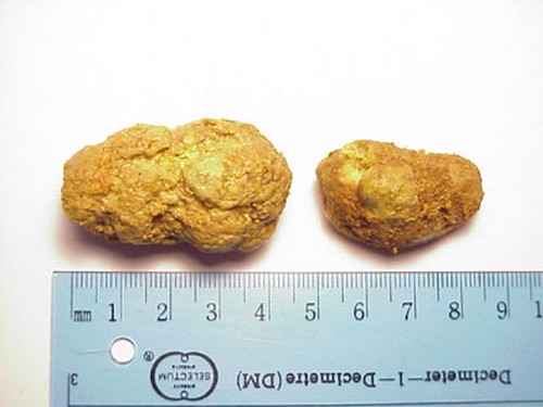 Размеры камней