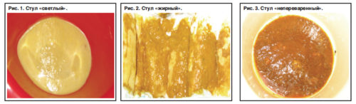 Кал при панкреатите у детей