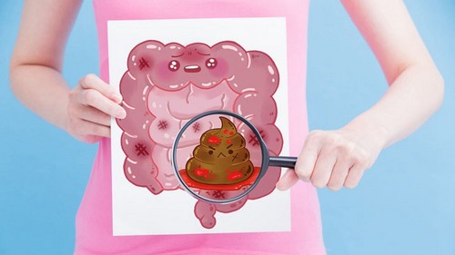 Симптомы срк с метеоризмом