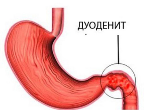 Что это такое