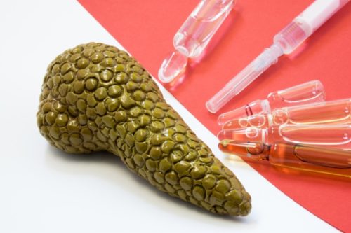 Калькулезный панкреатит – основные симптомы, правильное лечение, прогнозы