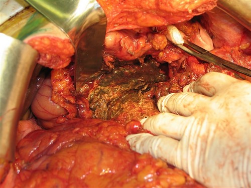 Как выглядит заболевание, фото