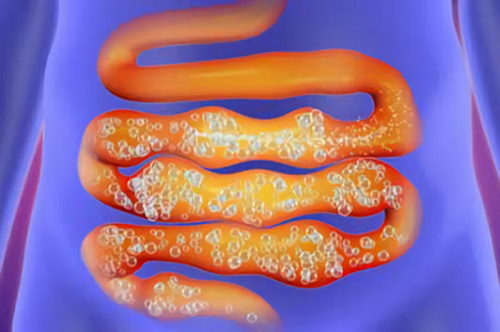 Синдром метеоризма причины возникновения и принципы лечения