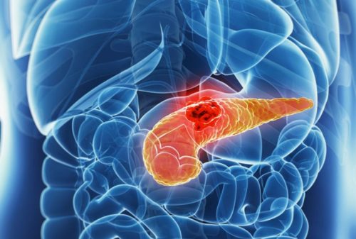 Симптомы жировой дистрофии поджелудочной